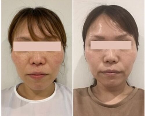 53C2C9D0-C5FE-41E8-B9B5-2FFA46BE37A4