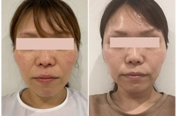 53C2C9D0-C5FE-41E8-B9B5-2FFA46BE37A4