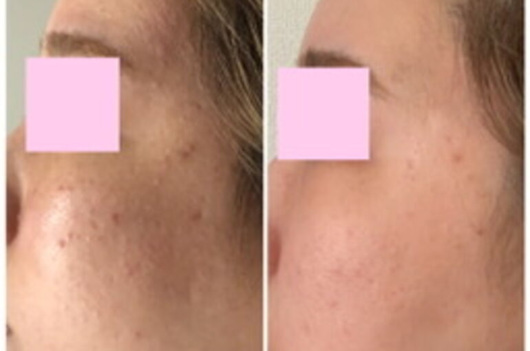 50EE9546-80D1-48C3-83D1-0FC070C34BE1