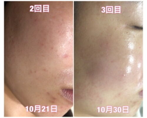 BDFF6E31-2682-438C-8AF2-A9722E0F6CA7