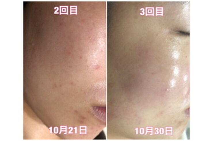 BDFF6E31-2682-438C-8AF2-A9722E0F6CA7