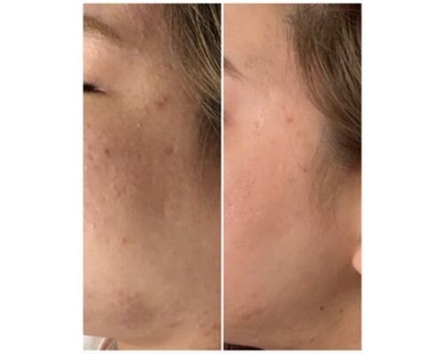 8A67AB5B-851B-4EE7-80F5-691C866B8A65