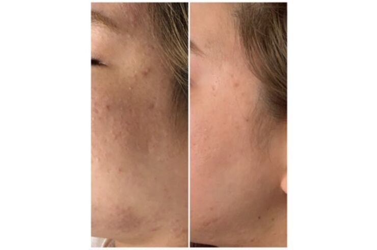 8A67AB5B-851B-4EE7-80F5-691C866B8A65