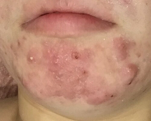 9570091E-6C07-47BF-8EFA-9225BAAA2C16