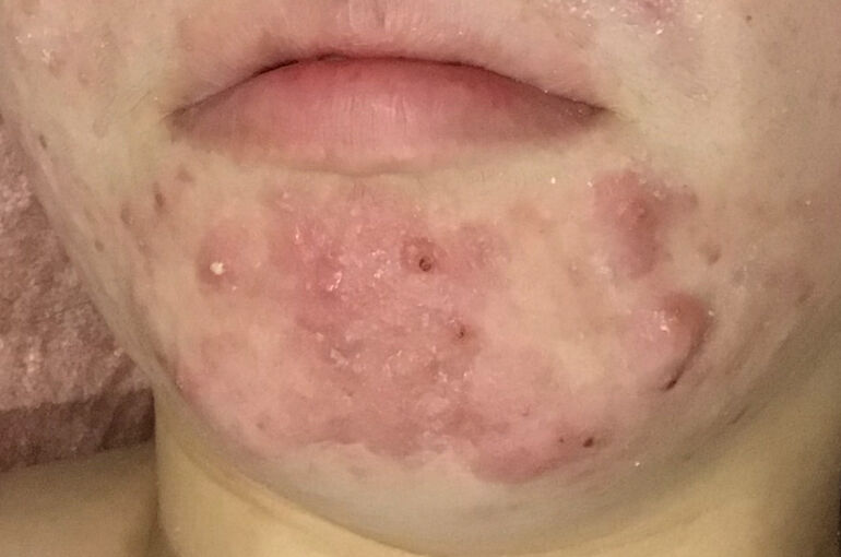 9570091E-6C07-47BF-8EFA-9225BAAA2C16