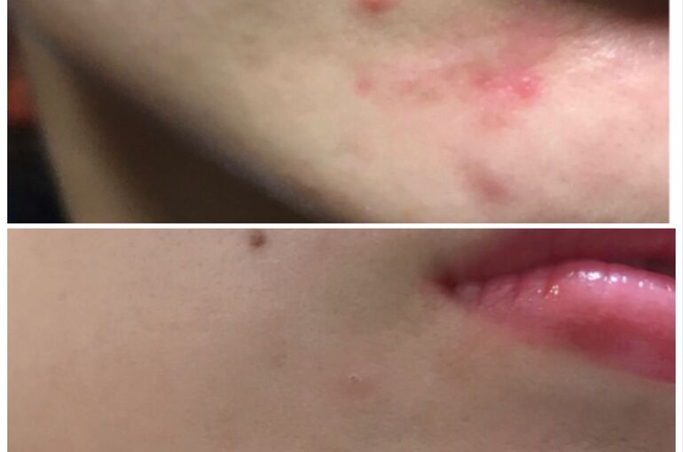 F86AAF70-794C-4034-B7CC-A5823E849746